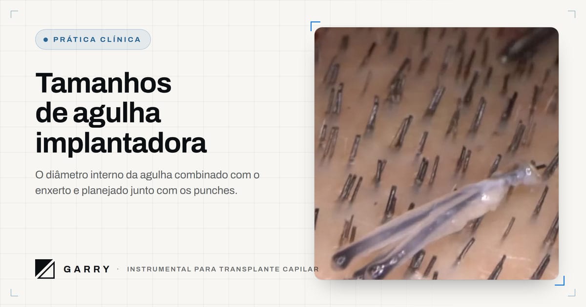 Tamanhos de agulha implantadora - enxerto de unidade folicular extraído sobre a área doadora