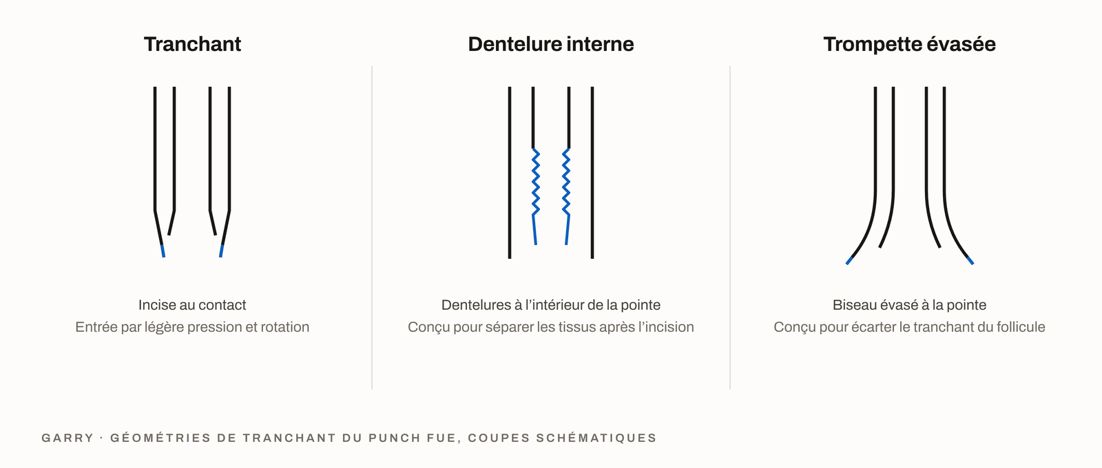Les géométries de tranchant de punch FUE affûté, dentelé et en trompette comparées en coupe transversale