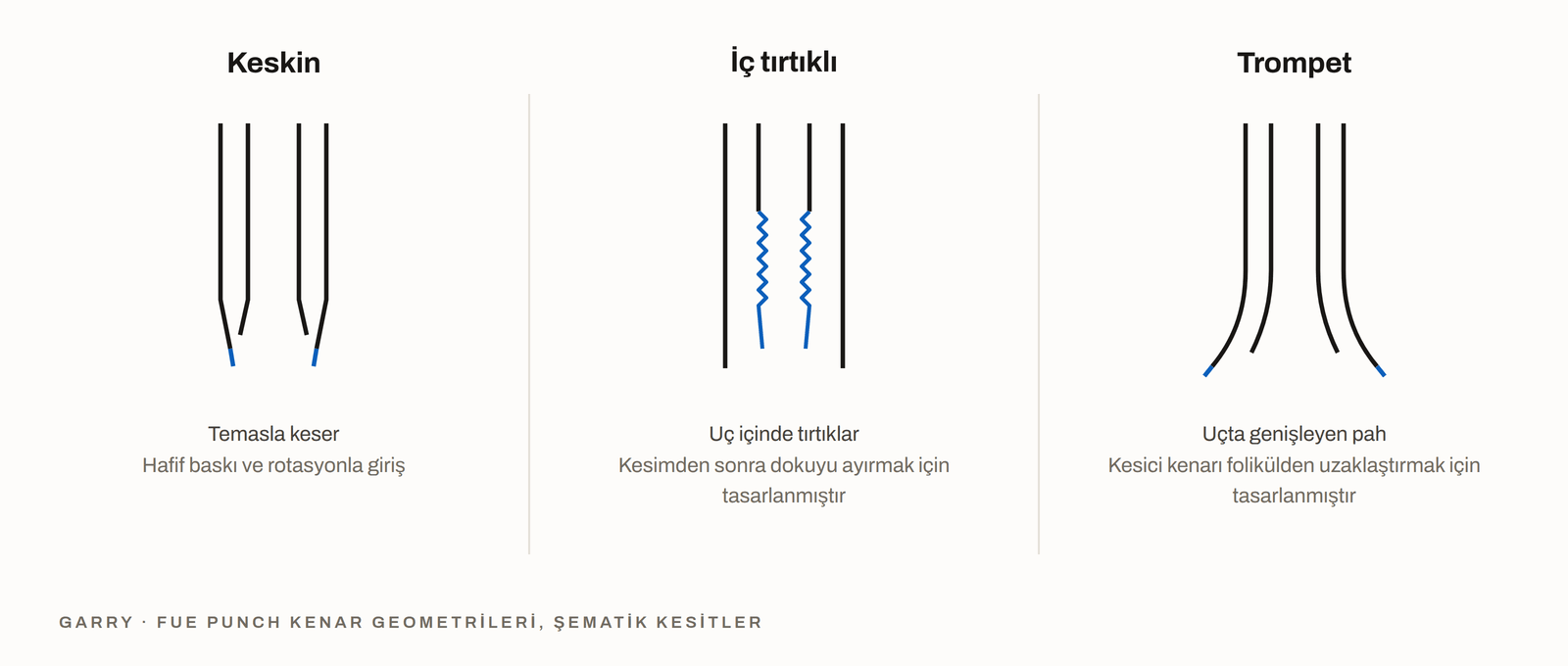 Keskin, tırtıklı ve trompet FUE punch kenar geometrilerinin kesit görünümünde karşılaştırması